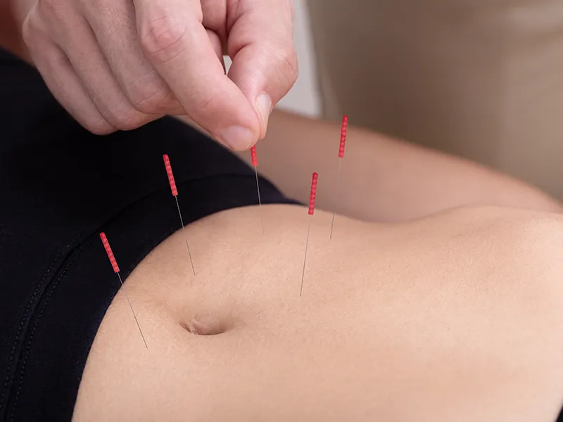 gut acupuncture