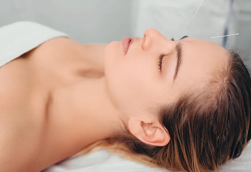 face acupuncture female