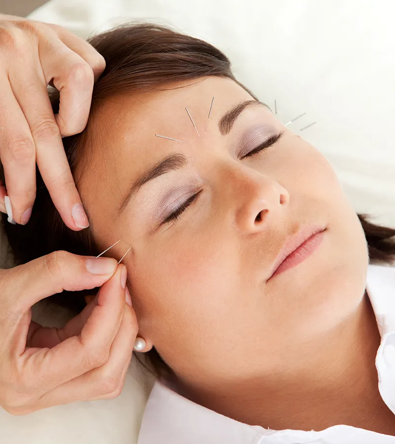 face acupuncture female