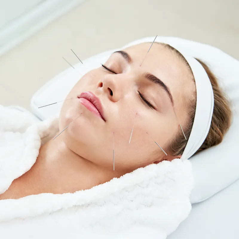 face acupuncture female